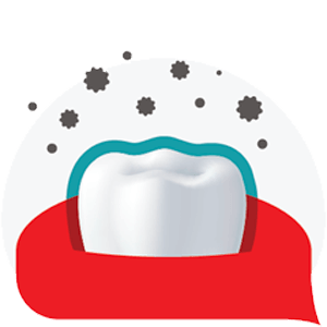 Fogszuvasodás-megelőzés