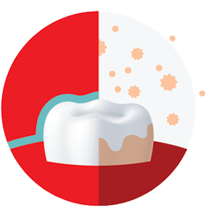 Lepedék megelőzése