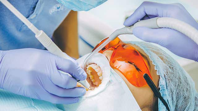 Proč Bychom Si Měli Bělit Zuby?