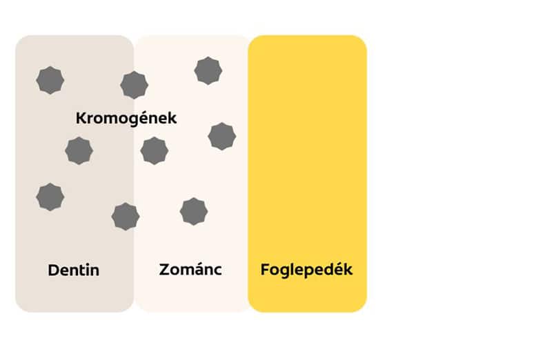 elszíneződött fog diagramja