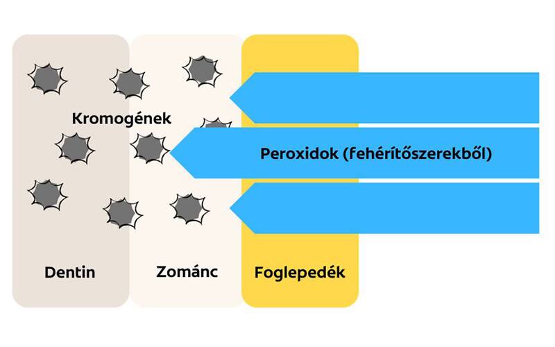 a fogfehérítés folyamatának ábrája